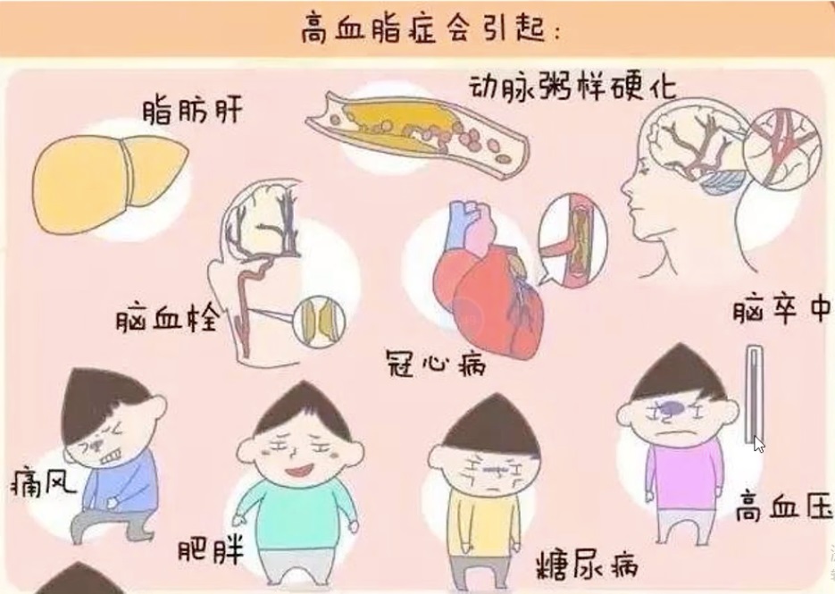 关于血脂，你需要了解哪些知识？