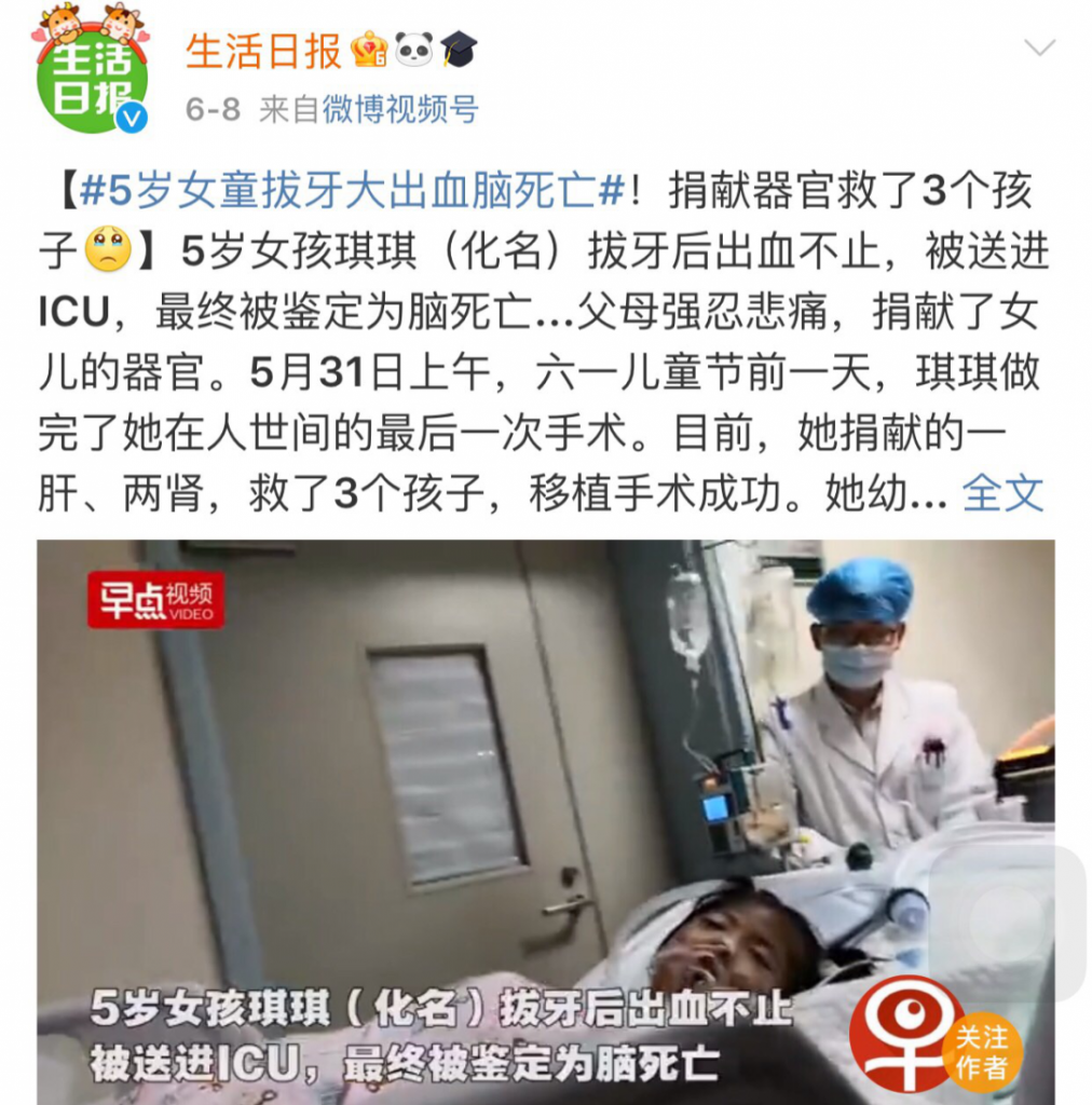 拔牙前一定要知道这些,千万不要不当回事!
