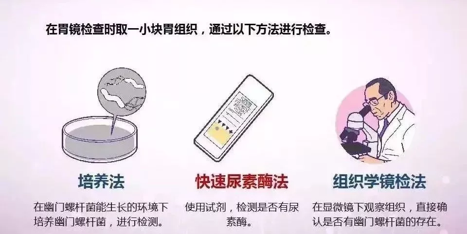如何用辨识幽门螺杆菌？