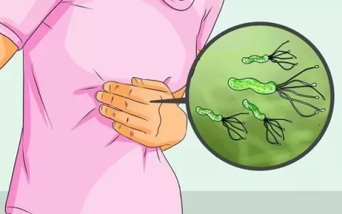 感染幽门螺杆菌必须治疗吗？