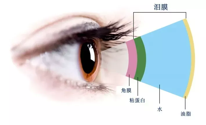 如何预防干眼症？
