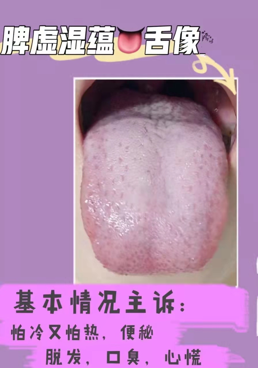 脾胃不好吃什么中成药？（健脾胃的中成药有哪些？）