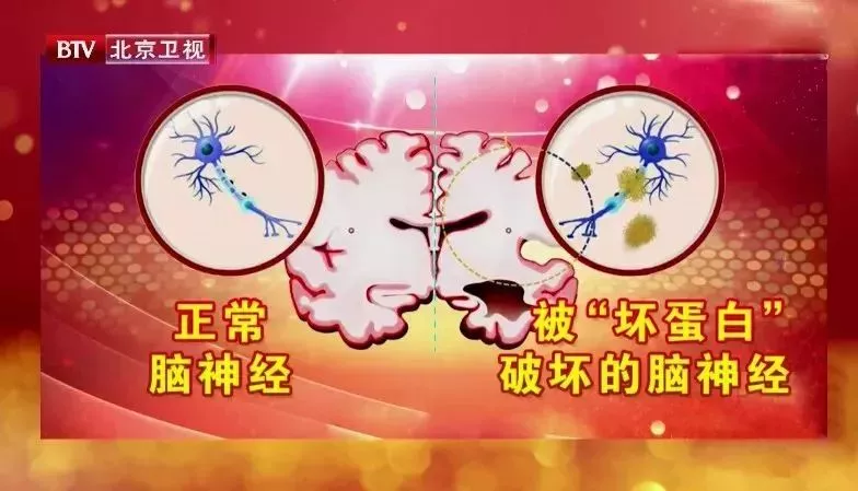 女性如何预防阿尔茨海默病（女性预防阿尔茨海默病的9个小贴士）