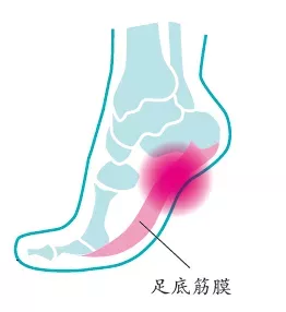 四种常见跑步疼痛的解决方案