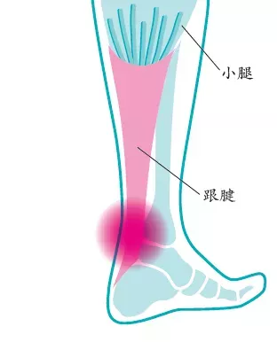 四种常见跑步疼痛的解决方案