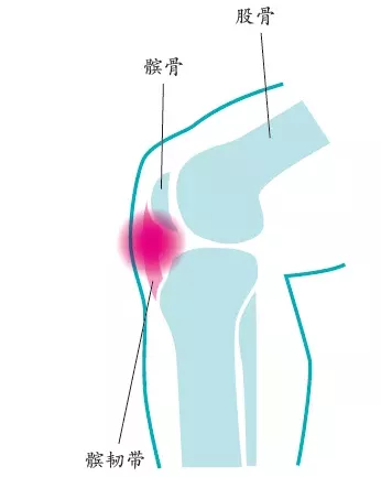 四种常见跑步疼痛的解决方案