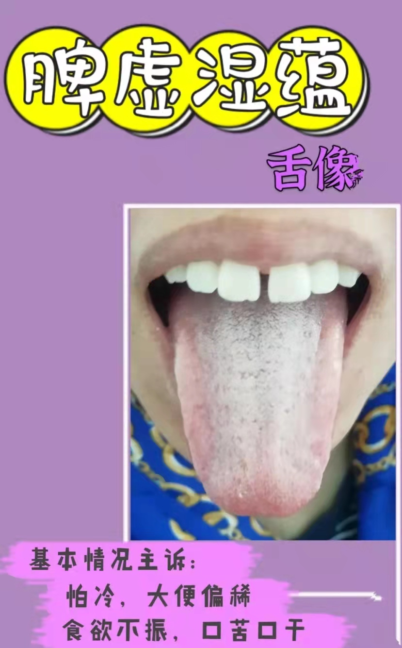 脾胃不好吃什么中成药？（健脾胃的中成药有哪些？）
