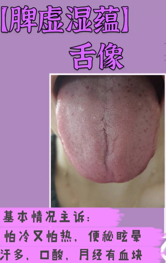 脾胃不好吃什么中成药？（健脾胃的中成药有哪些？）