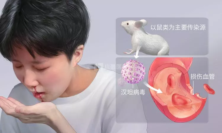 西安出现多例出血热患者！会人传人吗？