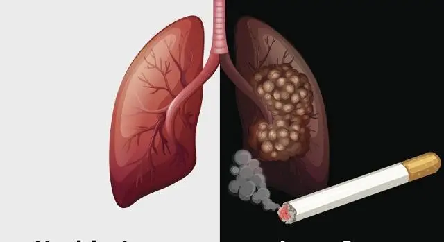 长期吸烟的人一下子戒烟，对身体有害吗？