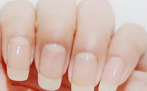 为什么有的人指甲上有月牙，有的人却没有？