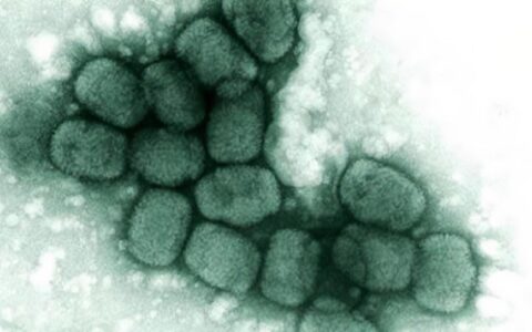 猴痘、天花、牛痘、水痘该怎么应对？
