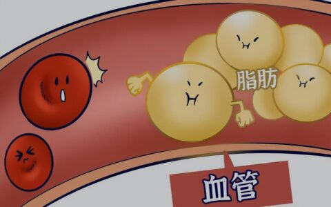 坚持每天跑步，可以降血脂吗？