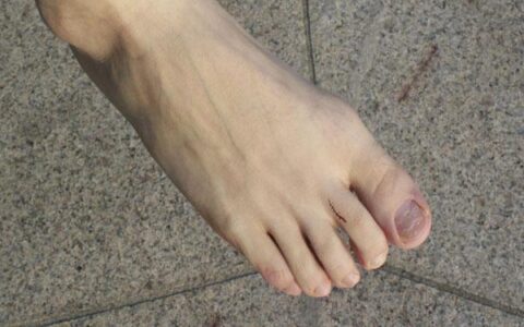 免疫力好的人都有哪些共性？