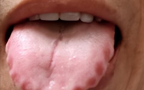身体有湿、寒、气、食四毒怎么办？
