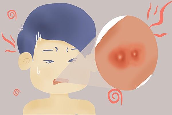 常吃辣椒上火又便秘该怎么办？