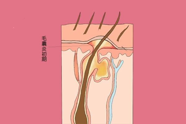 眉毛一根长，胜过万担粮，有何寓意？眉毛、鼻毛变白，何意？