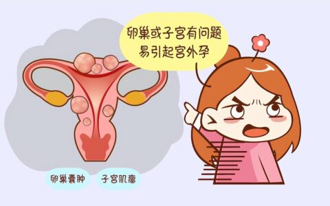 女性为什么容易长子宫肌瘤？