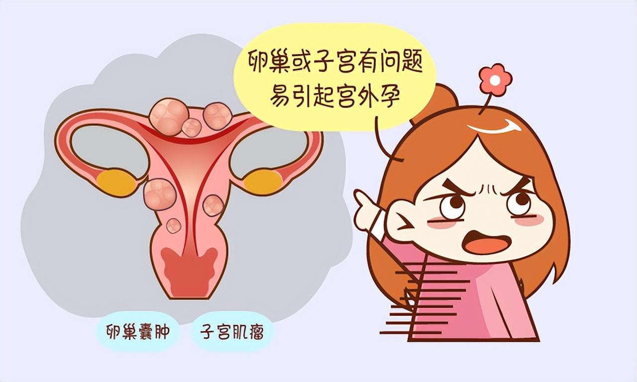 女性为什么容易长子宫肌瘤？
