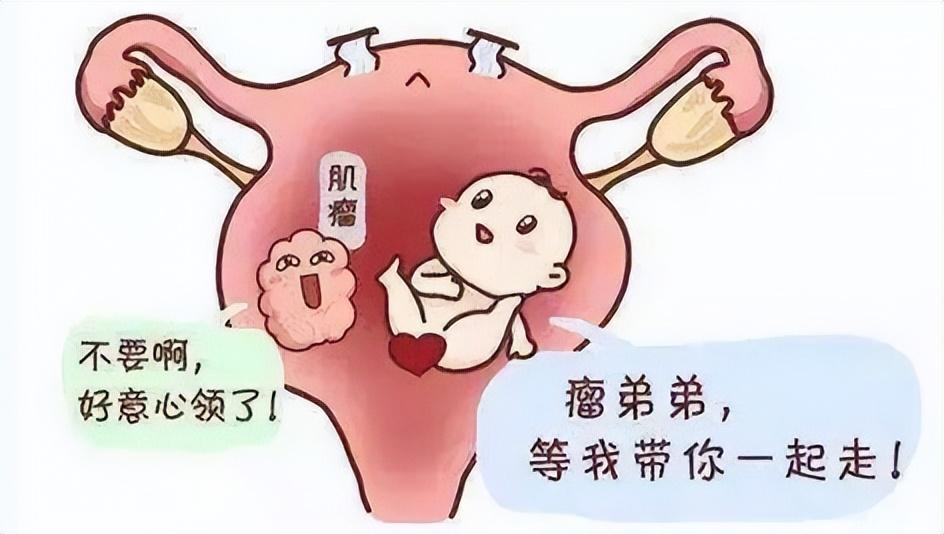 女性为什么容易长子宫肌瘤？