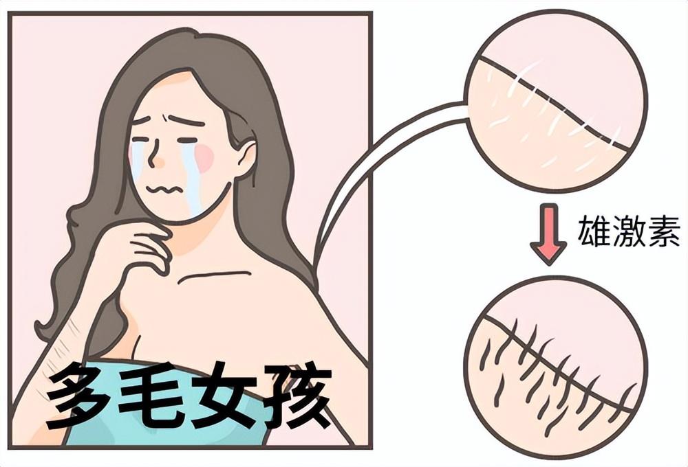 肛门毛太多,是什么原因造成的?能刮掉吗?