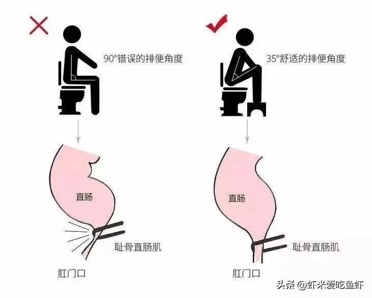 孕期便秘怎么办？几招教你解决孕期便秘
