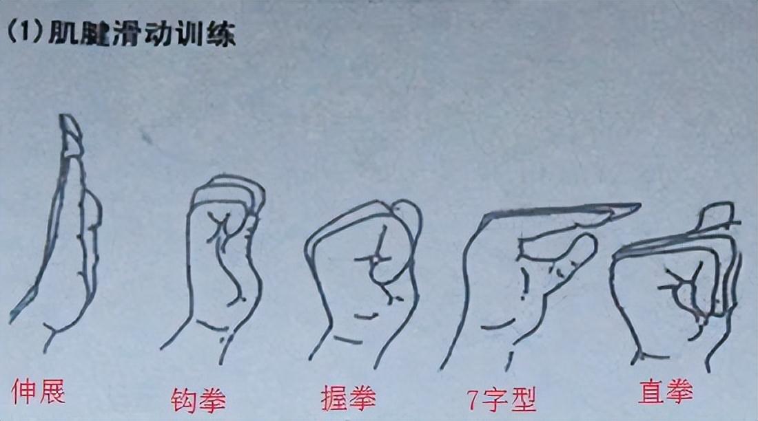 手部麻木、疼痛的几个常见原因及康复训练方法