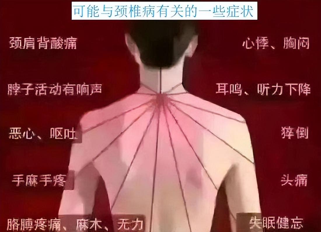 手部麻木、疼痛的几个常见原因及康复训练方法