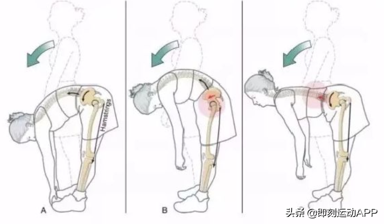 腰疼、膝盖痛的真正原因是什么？