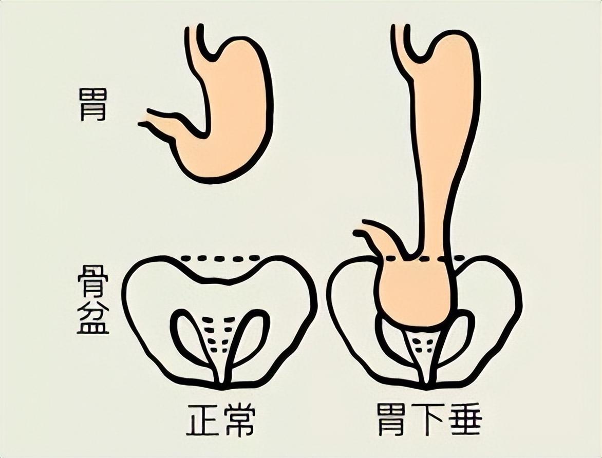中气不足应该怎么办？（如何补中气？）